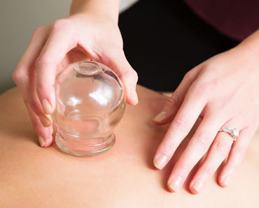 Hands In Demand Whitby ON - Cupping Therapy